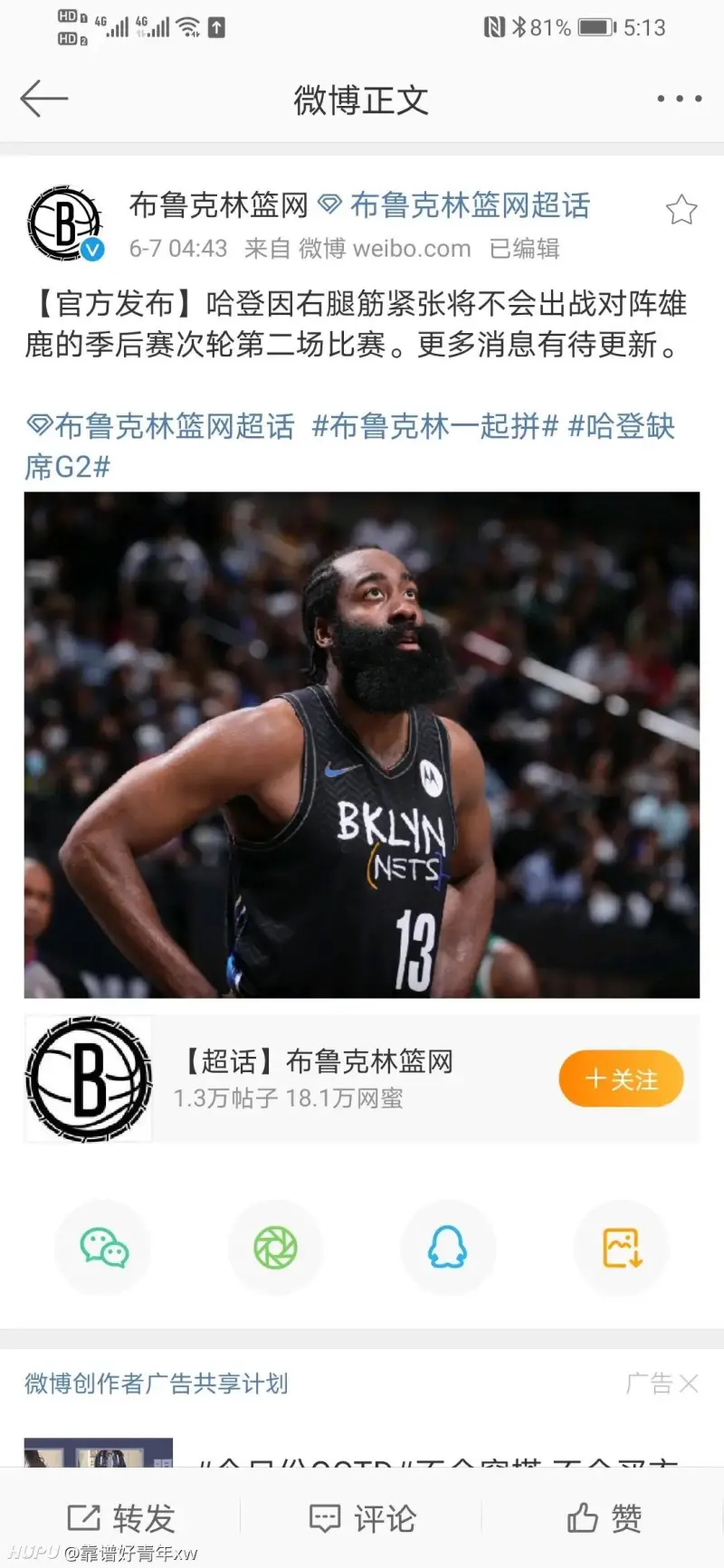 开云体育：球队伤病：76人队哈登腿筋拉伤，预计缺席数周的简单介绍
